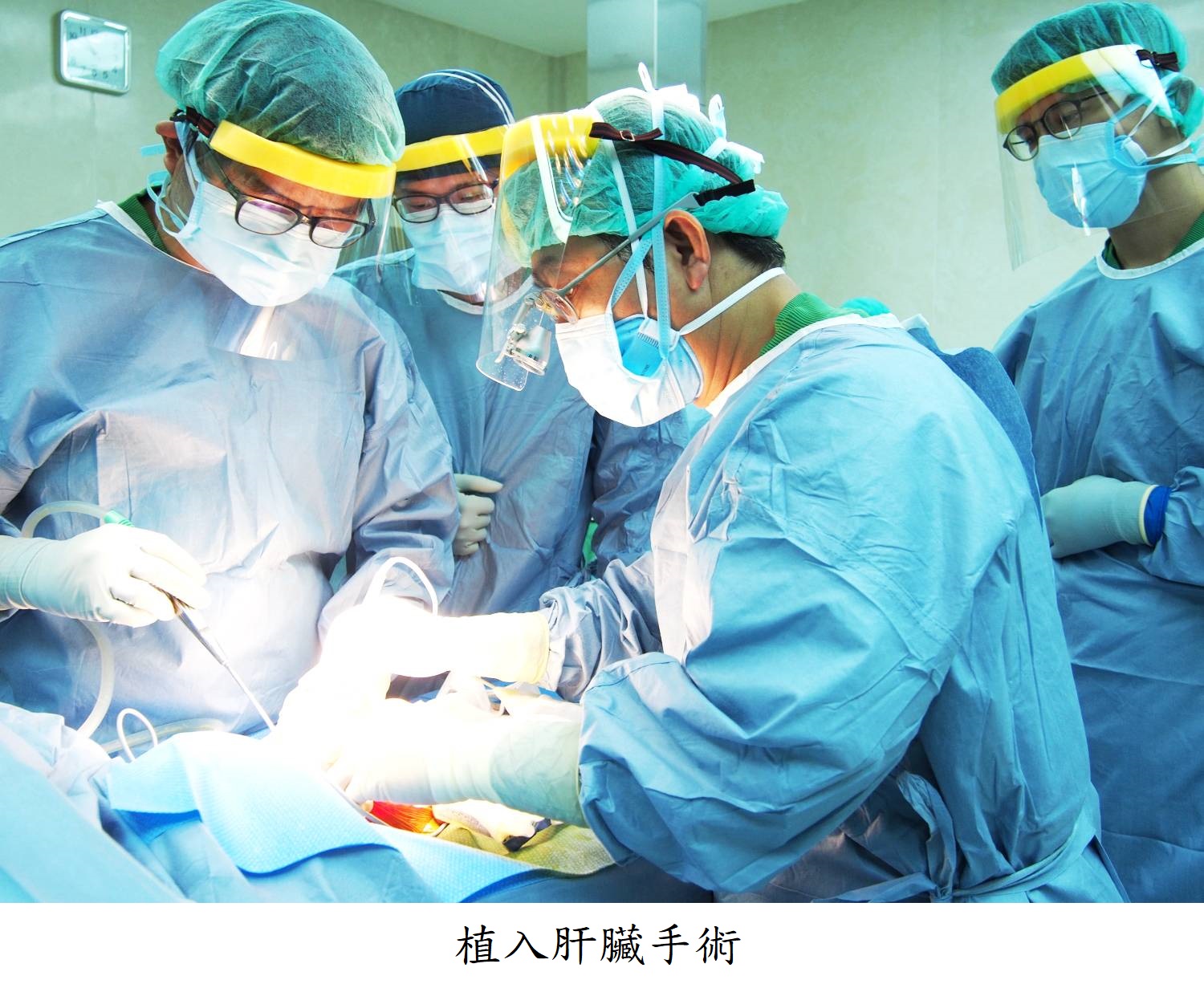 植入肝臟手術