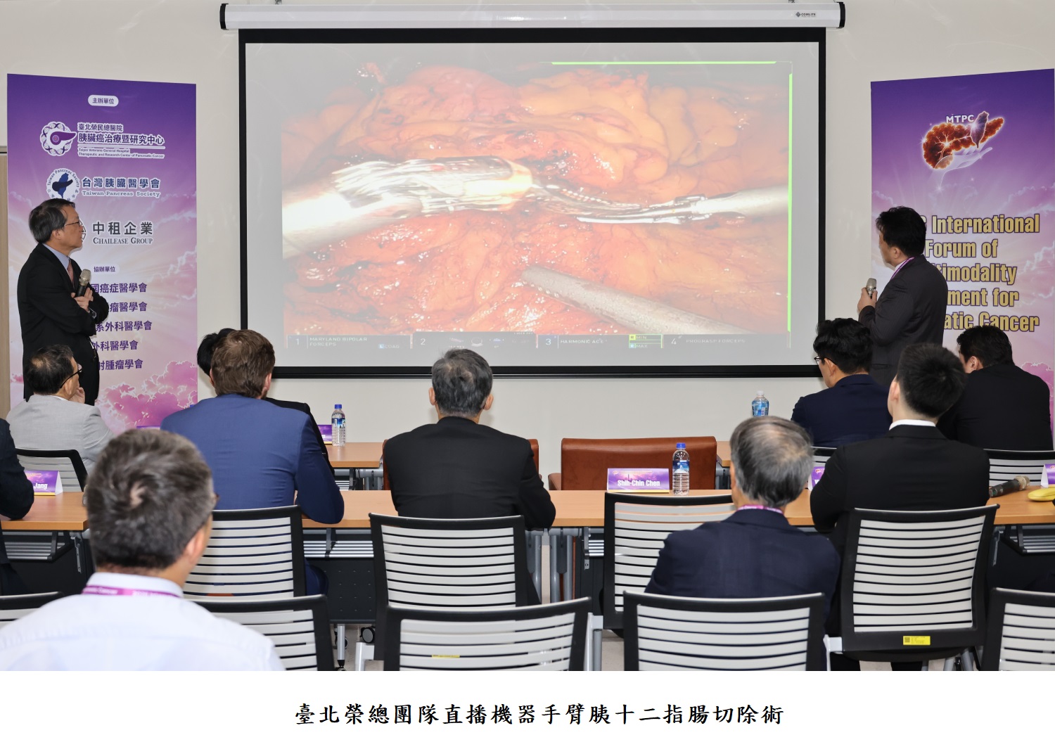 臺北榮總團隊直播機器手臂胰十二指腸切除術