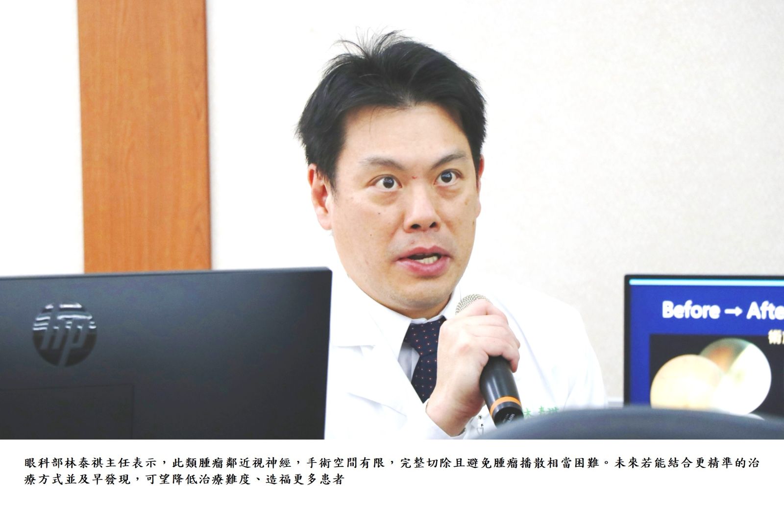 眼科部林泰祺主任表示，此類腫瘤鄰近視神經，手術空間有限，完整切除且避免腫瘤播散相當困難。未來若能結合更精準的治療方式並及早發現，可望降低治療難度、造福更多患者