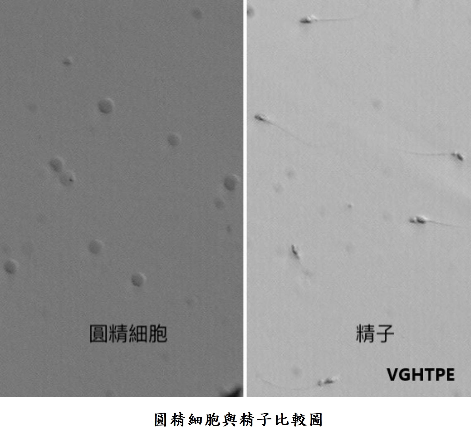 圓精細胞與精子比較圖