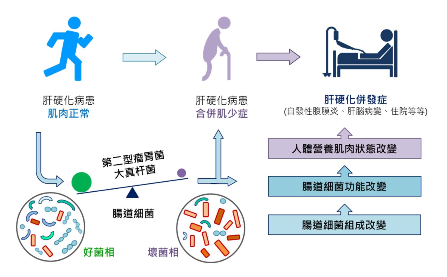 改變腸道細菌 可減少肝硬化合併肌少症及併發症